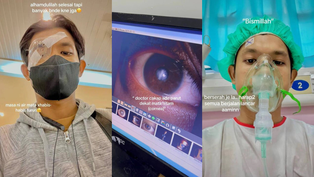 M’sian Shares How Excessive Eye Rubbing Led Him To Cornea Transplant Surgery 